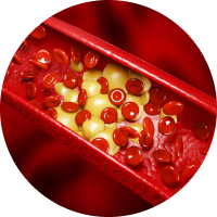 Thừa cân, mỡ máu